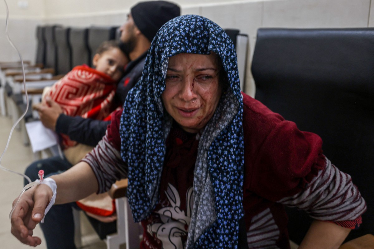 A victim of an Israeli army strike gestures as she receive treatment at Kuwait hospital in Rafah in the southern Gaza Strip on December 28, 2023. Photo by MOHAMMED ABED / AFP