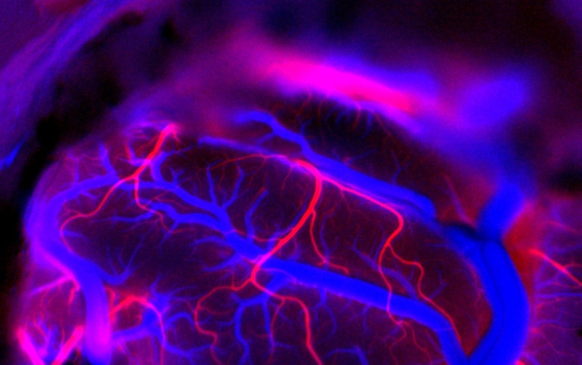 Fluorescent dye imaging that allows Neuralink robots to resolve smaller vessels and distinguish between arteries (red) and veins (blue) in this false color image. Picture: X / Neuralink